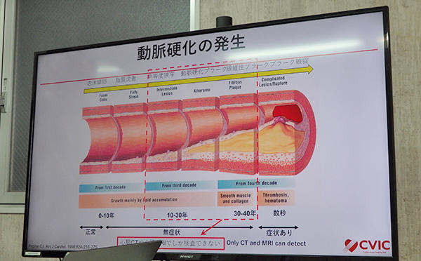 心血管病予防やACC/AHA脂質代謝異常ガイドライン改訂について解説